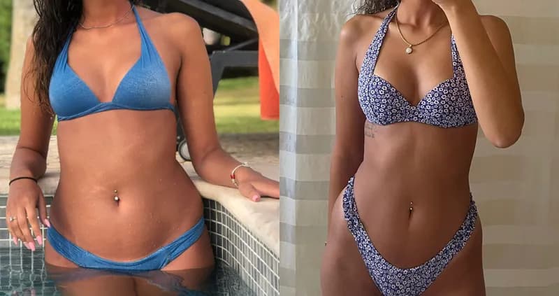 Definição muscular